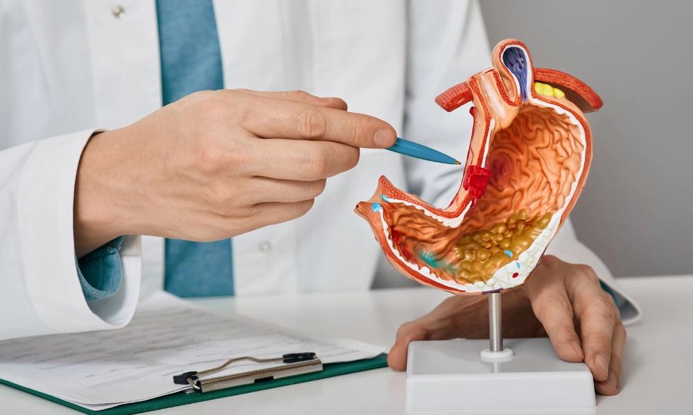 Viêm Loét Dạ Dày Và Những Điều Cần Biết